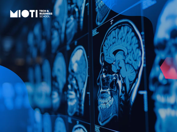 Machine Learning e IA, una esperanza para los pacientes con TOC
