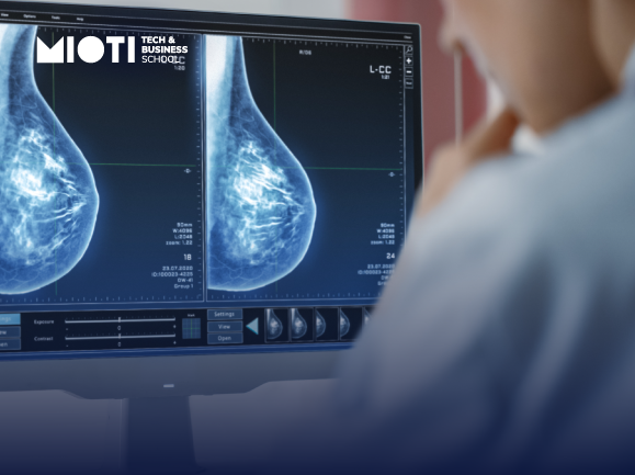 Clairity Breast, mamografía inteligente